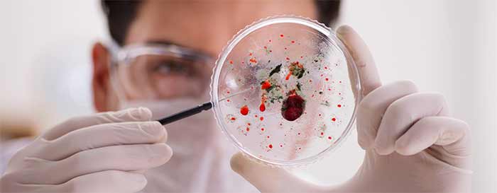 تشخیص نوین بیماری های عفونی