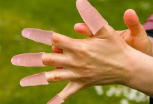 معرفی مراکز پروتز انگشت دست در شیراز